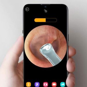 گوش پاک کن هوشمند Bebird R1 Smart Visual Ear Cleaning